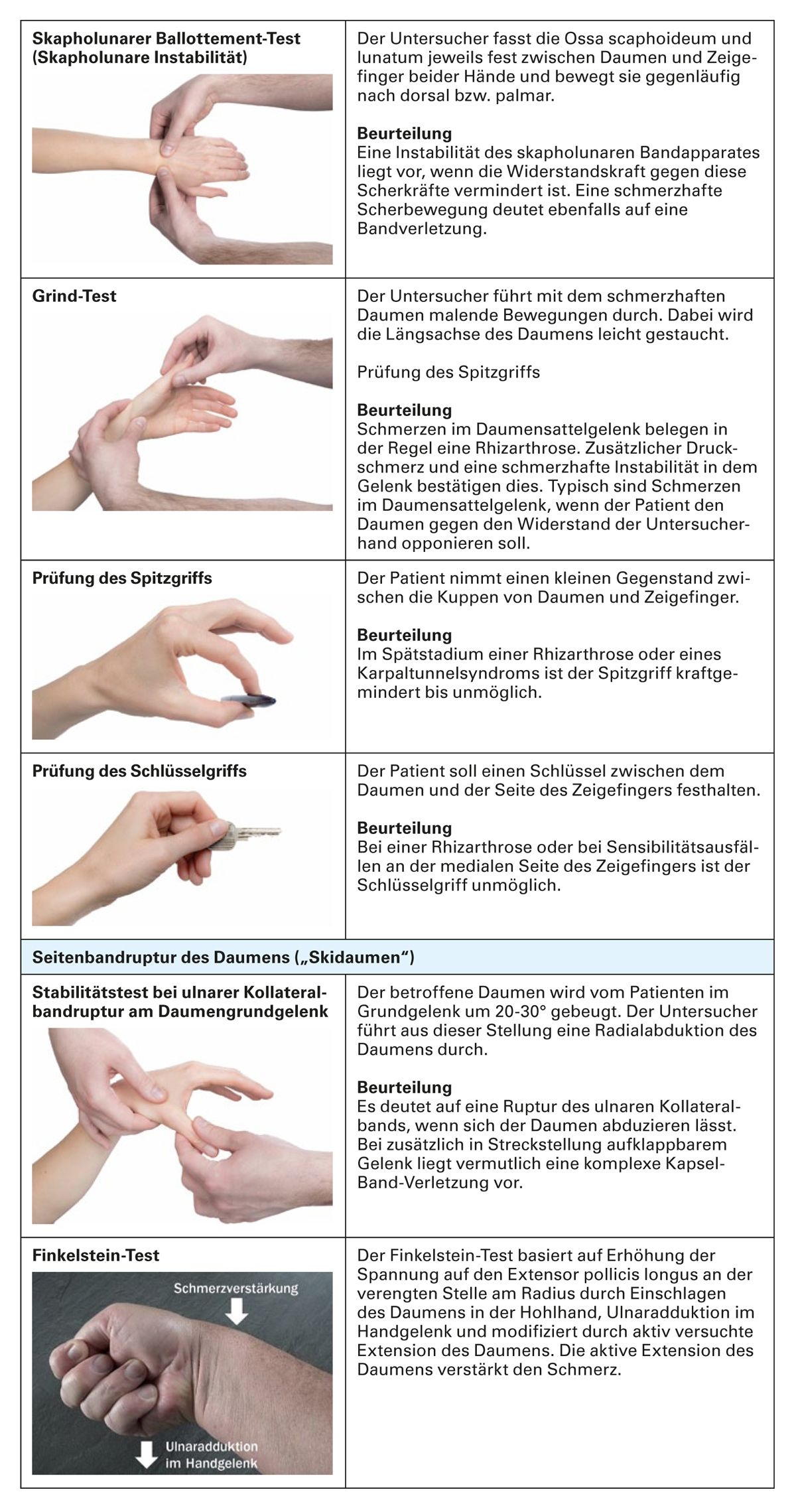 Verletzungen Und Erkrankungen An Handgelenk Und Daumenstrahl 